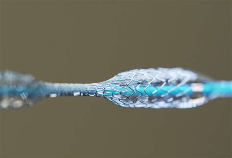  Nitinol: Materiale Magnetico per Impianti Medici e Robotica Innovativa!